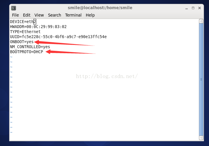 详解Linux系统无法上网解决方案